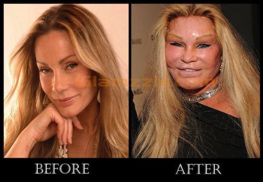  Bizarre Things That The Ultra Rich Spend Their Money On-Jocelyn Wildenstein's Plastic Surgery